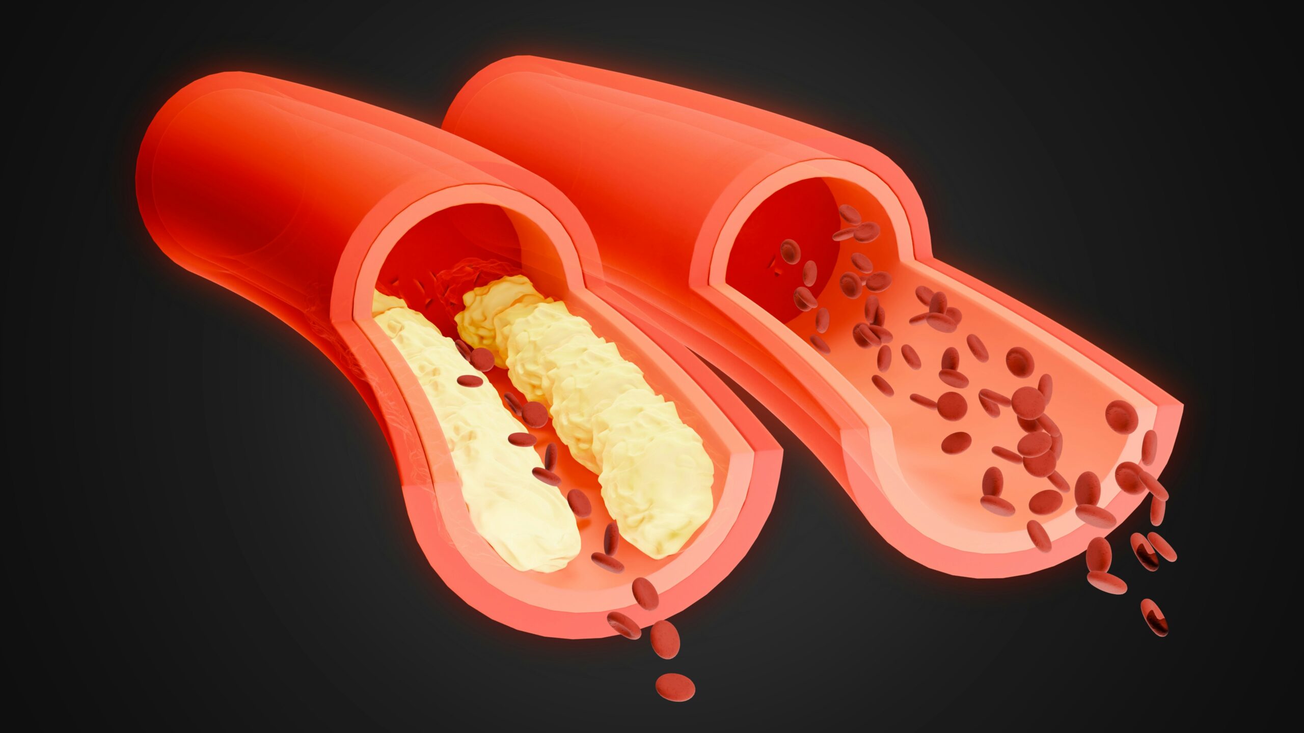 Vascular Disorders